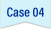 Case04
